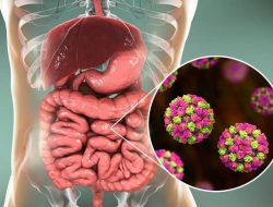 Kasus Norovirus terus meningkat. Berikut hal-hal yang perlu Anda ketahui tentang virus berbahaya ini